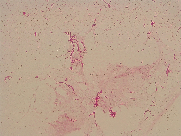 Bacillus Slides - Bacillus 04 400X